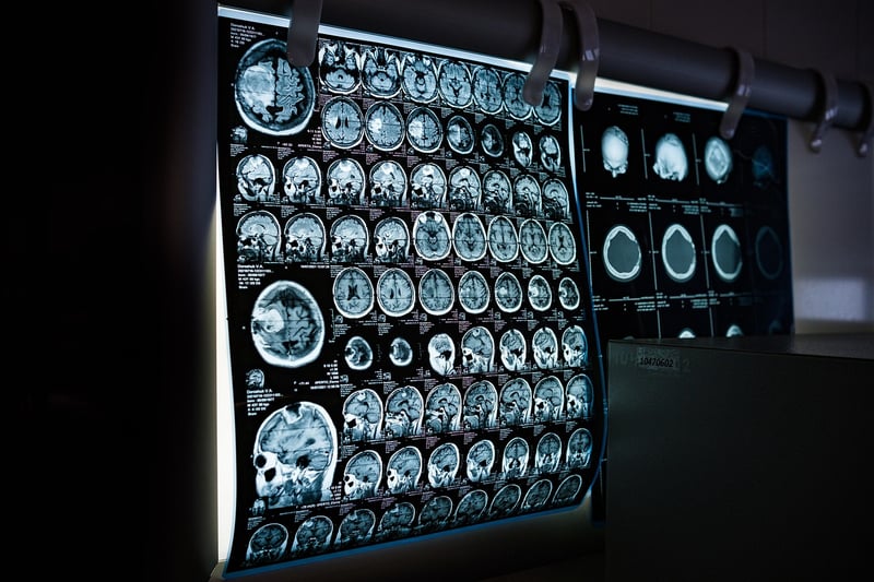 Body Scan for Relaxation